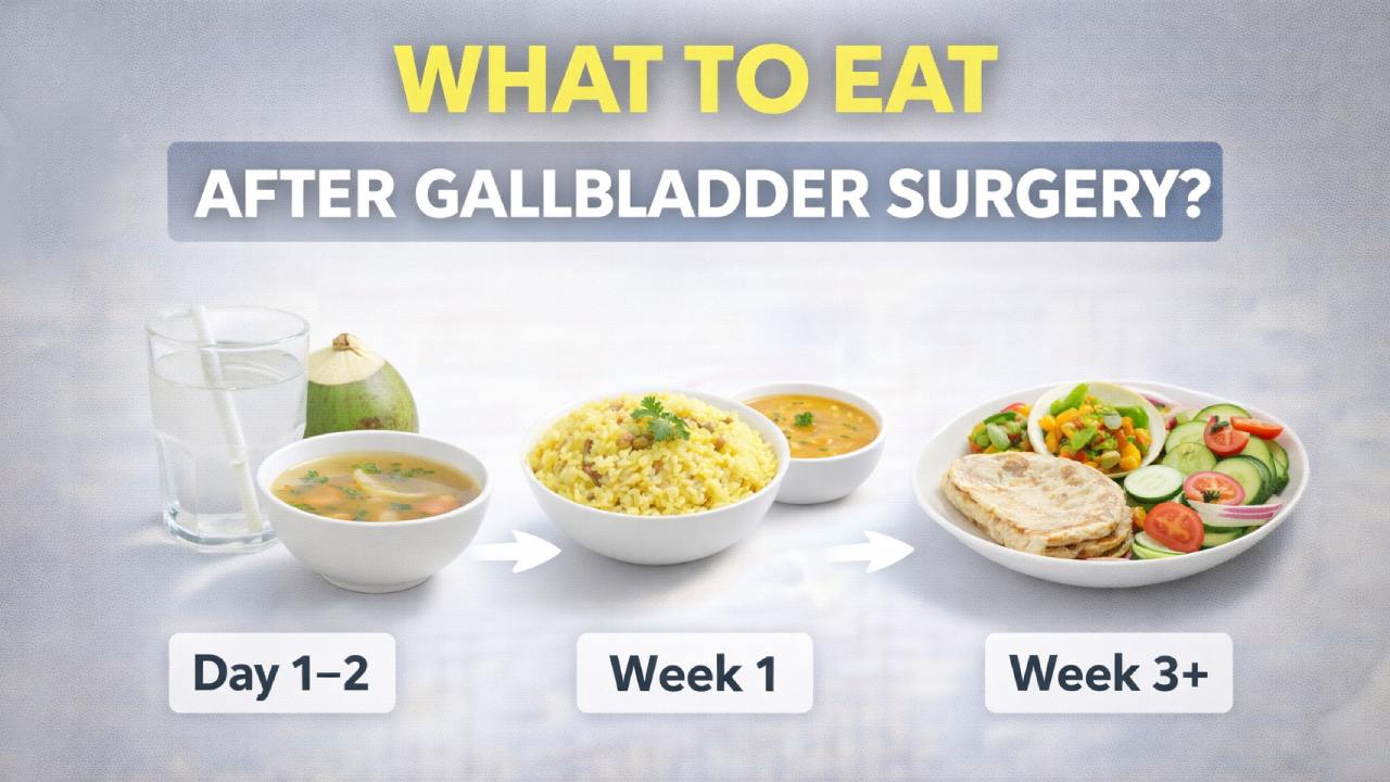 Gallbladder Removal? Here’s the Exact Diet After a Cholecystectomy You Must Follow for Faster Recovery