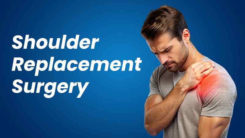 Shoulder Replacement Surgery